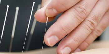 A UB student in the Acupuncture Institute